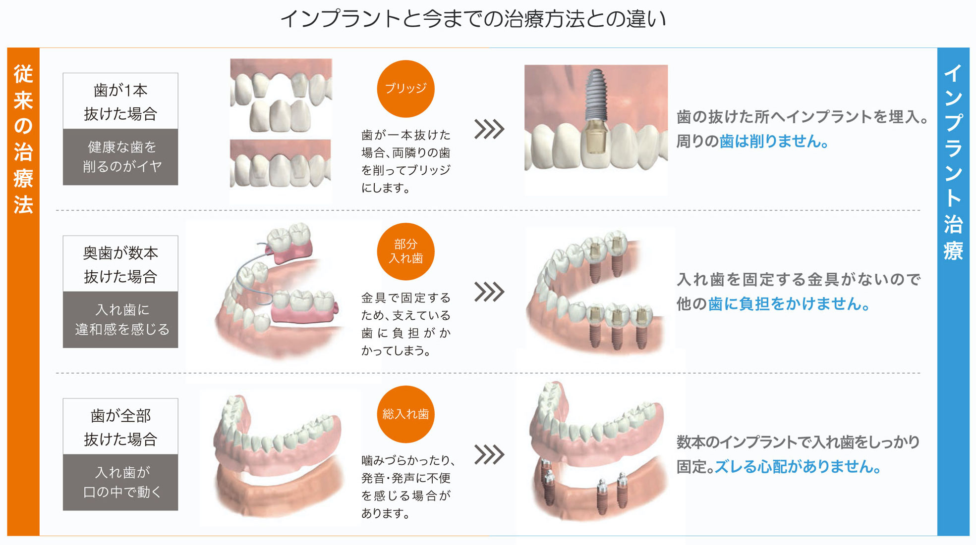 歯科用CT、エールガイド